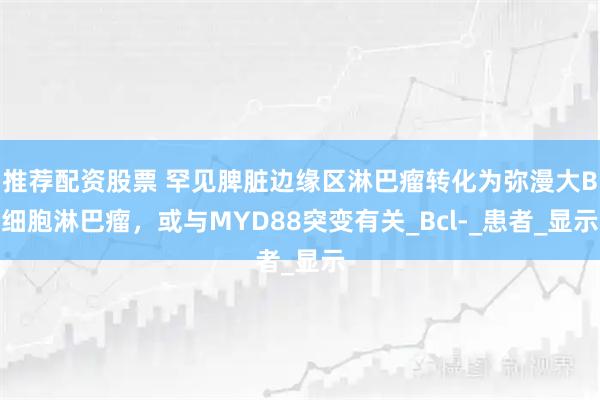 推荐配资股票 罕见脾脏边缘区淋巴瘤转化为弥漫大B细胞淋巴瘤，或与MYD88突变有关_Bcl-_患者_显示
